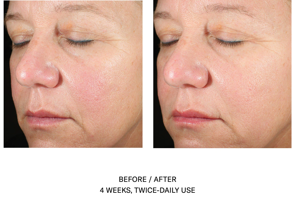 SkinBetterScience Alto Advanced Defense and Repair Serum™ 30ml