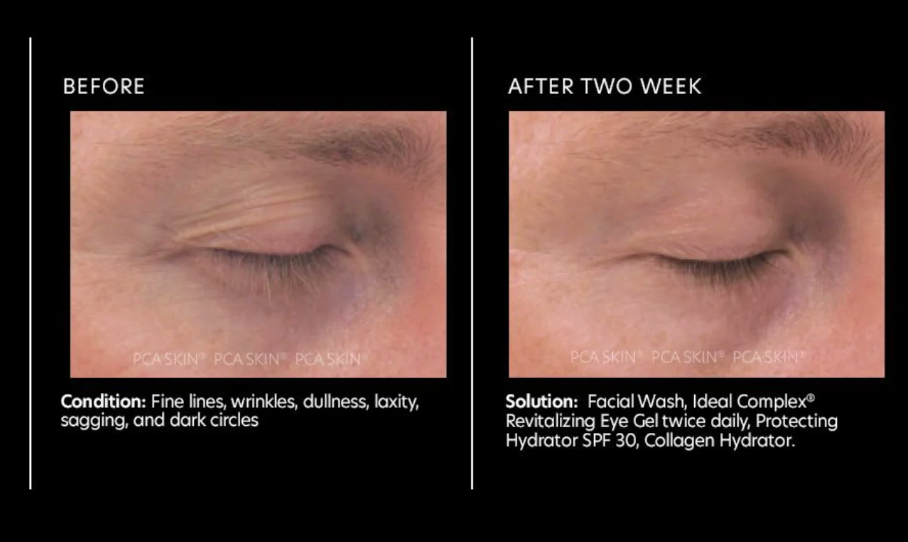 PCA SKIN Ideal Complex Revitalizing Eye Gel 14g