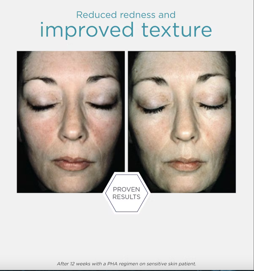 NEOSTRATA "Restore" Bionic Face Cream 40g