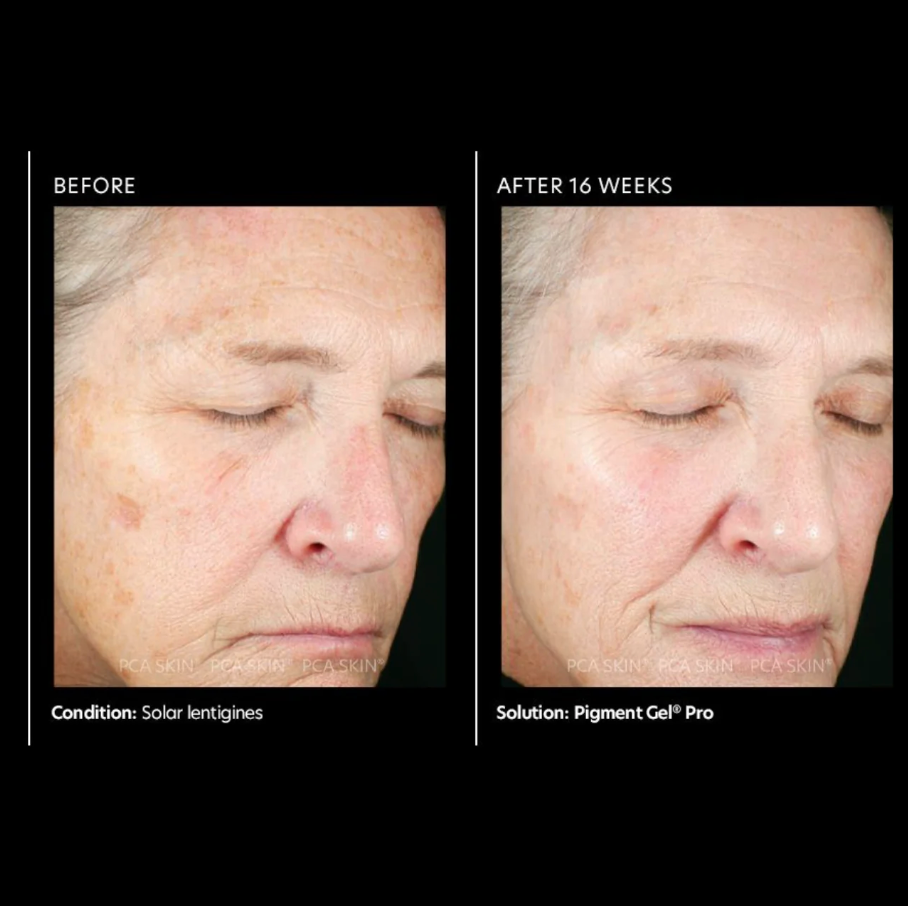 PCA SKIN Pigment Gel Pro 7ml (sample)