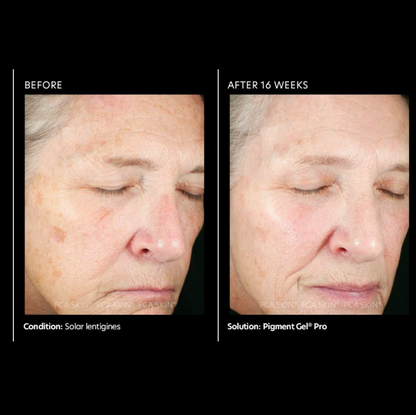 PCA SKIN Pigment Gel Pro 7ml (sample)