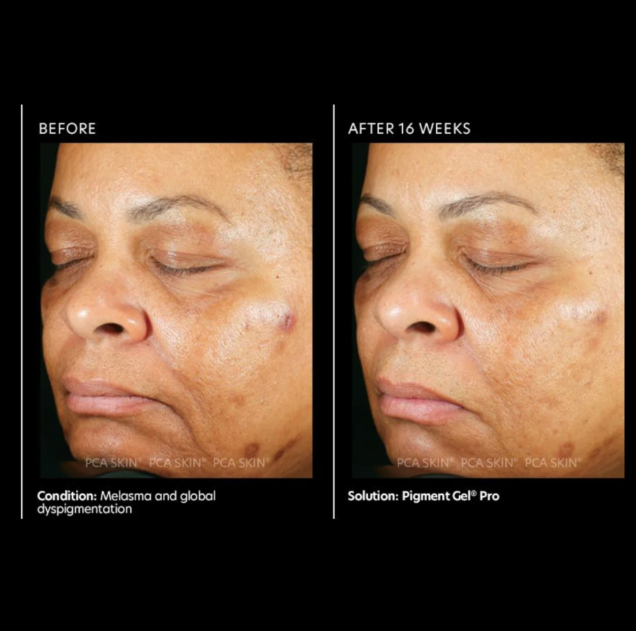 PCA SKIN Pigment Gel Pro 7ml (sample)
