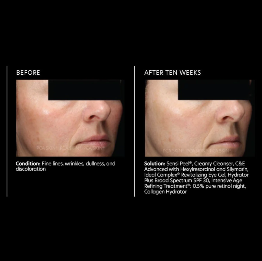 PCA SKIN C&amp;E Advanced Antioxidant Treatment 28g