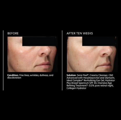 PCA SKIN C&amp;E Advanced Antioxidant Treatment 28g