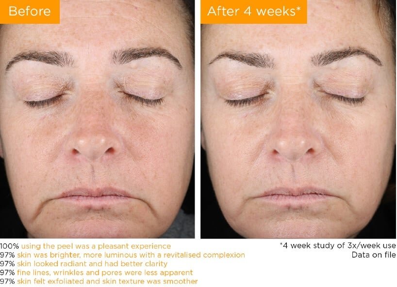 NEOSTRATA "Enlighten" Dual Acid Brightening Peel 50ml