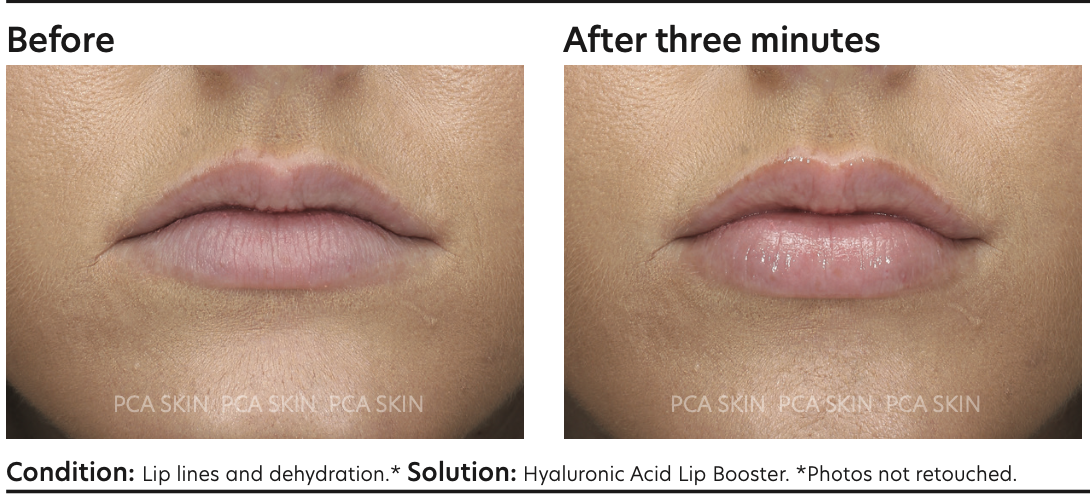 PCA SKIN Hyaluronic Acid Lip Booster 6.8g