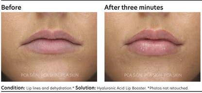 PCA SKIN Hyaluronic Acid Lip Booster 6.8g